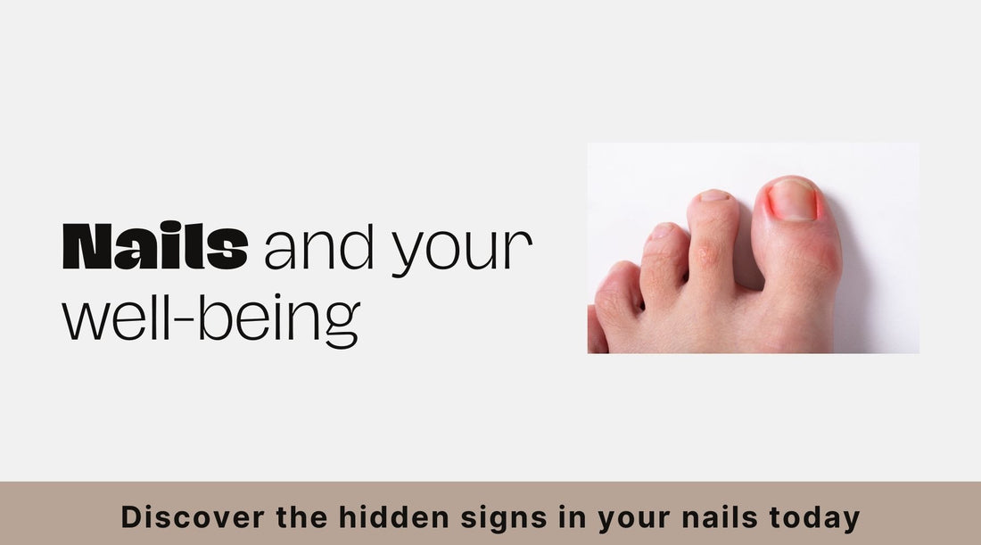 Nails as Health Indicators: What Your Nails Reveal About Your Overall Well-being