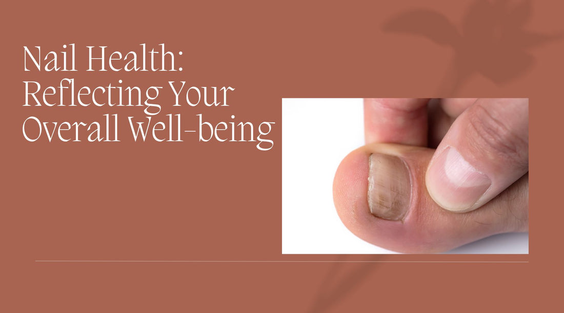 Your Nails: A Reflection of Your Health